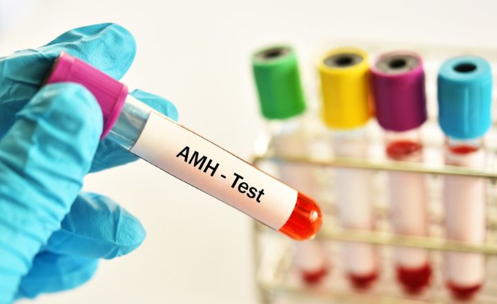 AMH Test Explained: A Comprehensive Guide to Ovarian Reserve Assessment